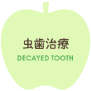 虫歯治療